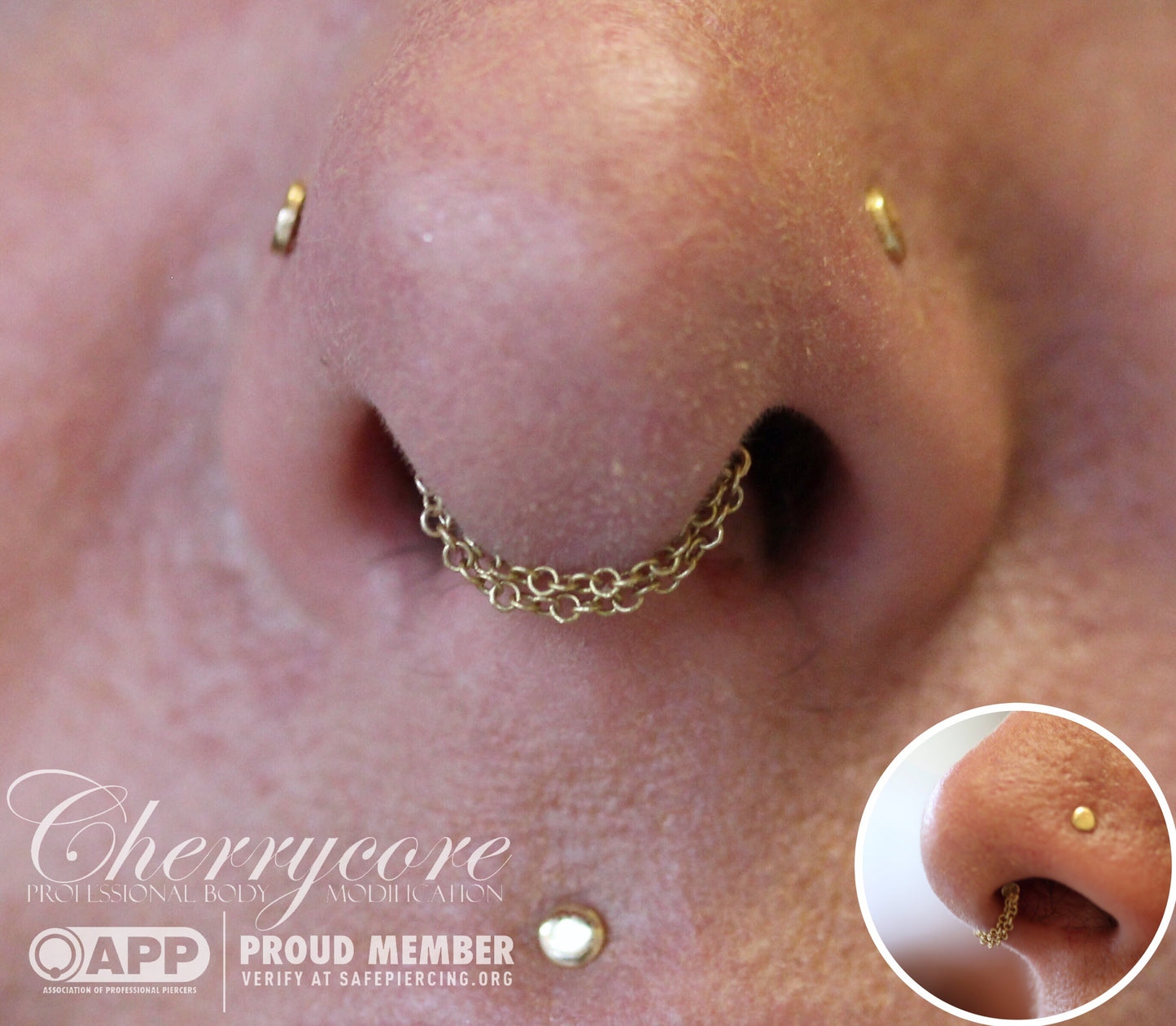 Double Chain Septum Spinner